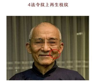 金縷紋面相|面相：臉上4種法令紋，事業有成又長壽，你有哪一。